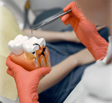 What is Bone Grafting: Procedure, Cost, Benefits & Aftercare