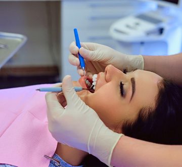 10 Reasons Dental Sealants in Clear Lake Prevent Cavities